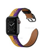 Printed Genuine Leather Watch Band for Apple Watch Series 10 42mm / 9 8 7 41mm / 6 5 4 SE SE (2022) SE (2023) 40mm / 3 2 1 38mm - Yellow / Purple Stripe